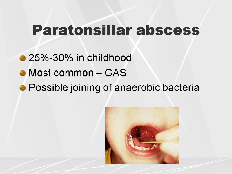 25%-30% in childhood Most common – GAS Possible joining of anaerobic bacteria  Paratonsillar